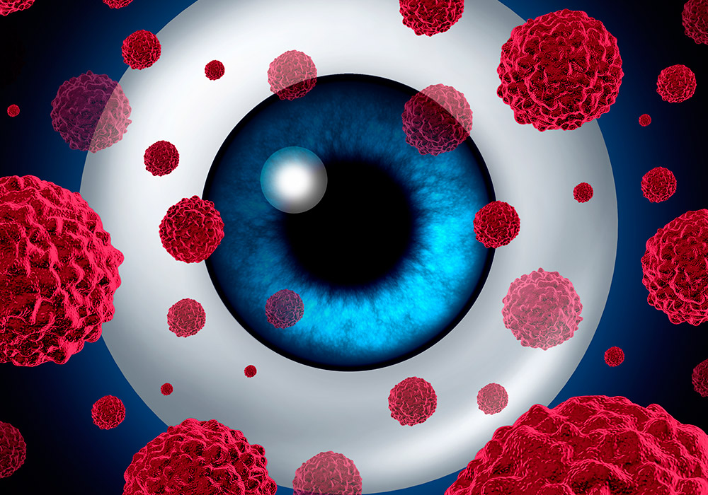 Oncologia ocular